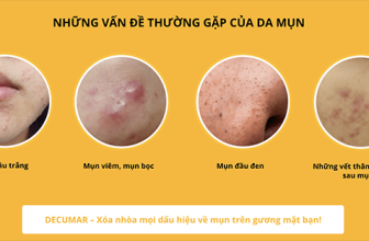 Kem trị thâm mụn